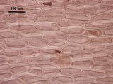 7 - Visione superficiale delle cellule corticali nella porzione prossimale del tallo